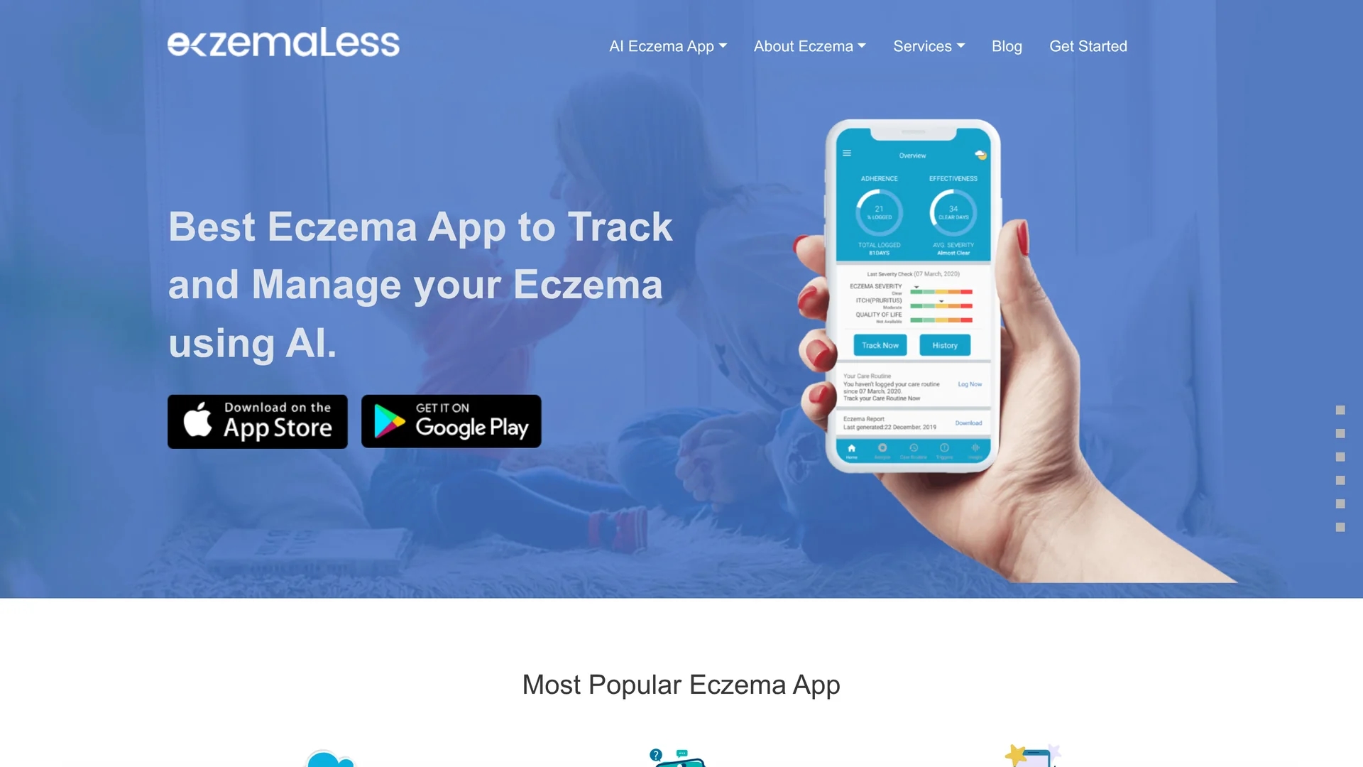 ai-eczema-app homepage